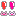 ビックリ